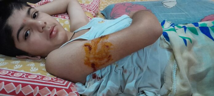 stray kurtas cut and injured the child1