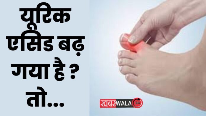 Uric Acid
