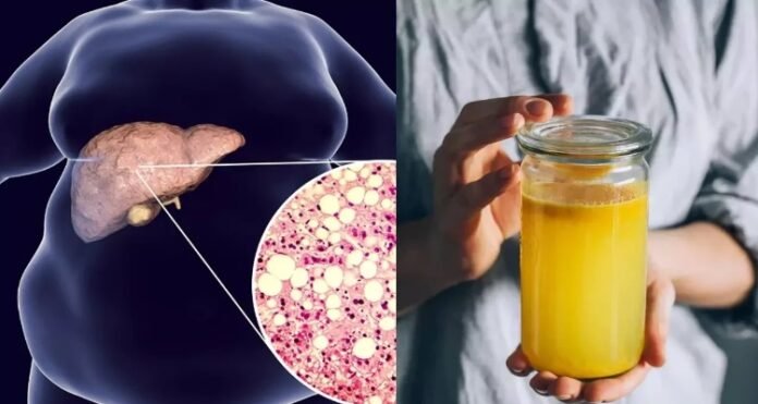 Turmeric Drink Fatty Liver