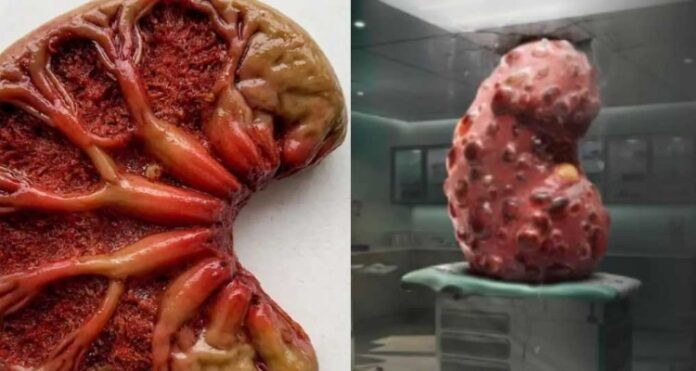 Kidney