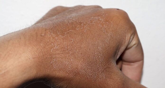 Skin Care in Winter
