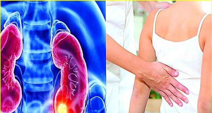 Kidney Disease Symptoms