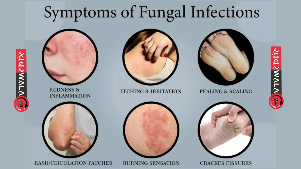 Symptom of fungal infection Symptom of fungal infection