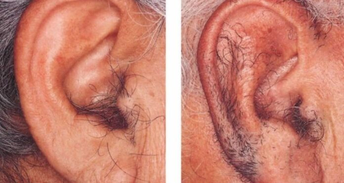 Ear Hair Samudrik Shastra कानों पर उगते बाल बताते हैं किस्मत का राज़, जीवन में अच्छे-बुरे बदलावों का हो सकता है संकेत, जानिए चौंकाने वाली बातें