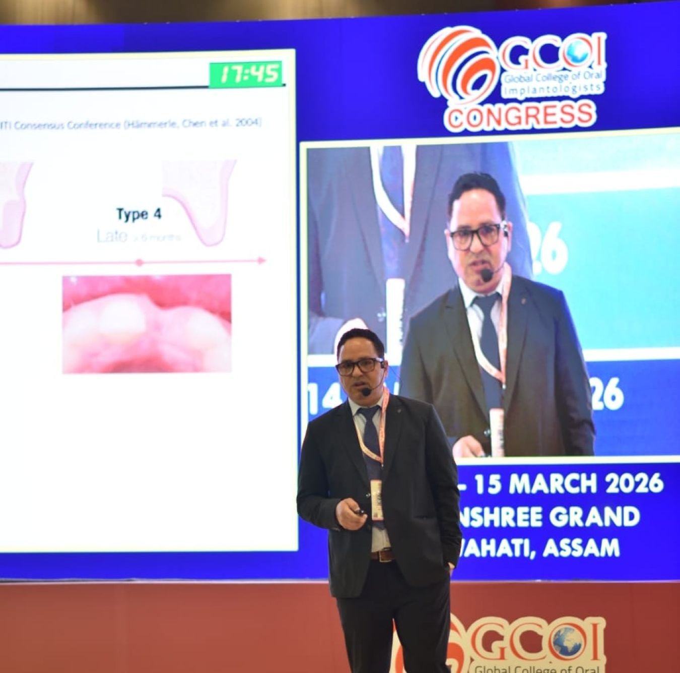 Hapur news डेंटल इम्प्लान्ट क्षेत्र में डॉ. एस. पी. सिंह की उपलब्धि,ग्लोबल इम्प्लान्टोलॉजिस्ट सम्मेलन में दिखाया जलवा 1 Hapur news डेंटल इम्प्लान्ट क्षेत्र में डॉ. एस. पी. सिंह की उपलब्धि,ग्लोबल इम्प्लान्टोलॉजिस्ट सम्मेलन में दिखाया जलवा